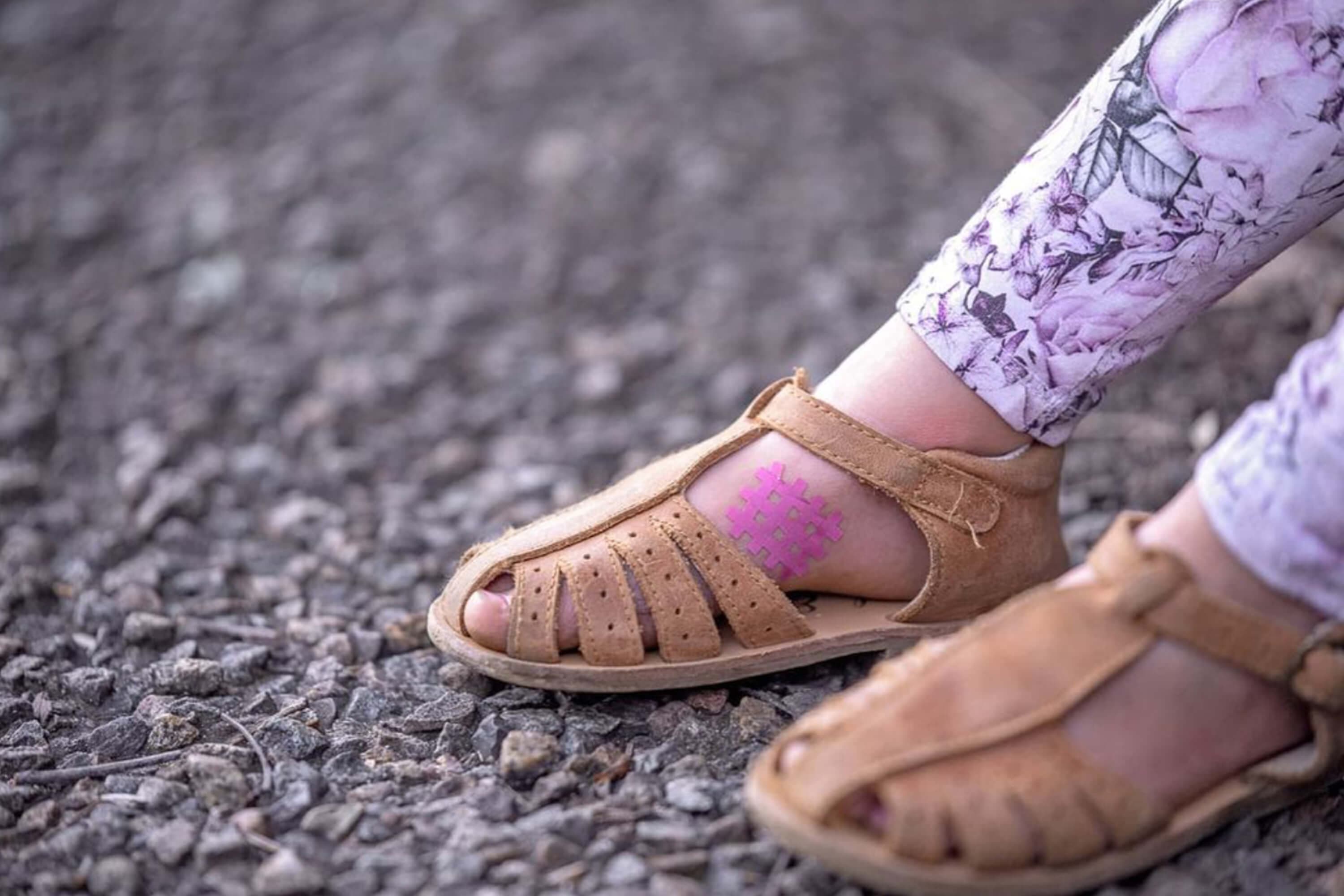 MagicPatch Itch Relief Patches | Anti-Itch Treatment for Mosquito Bite Relief - Image 10